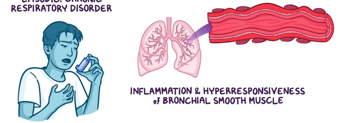 Bronchial Asthma (Tamak Shwas) Ayurvedic Therapeutic Program