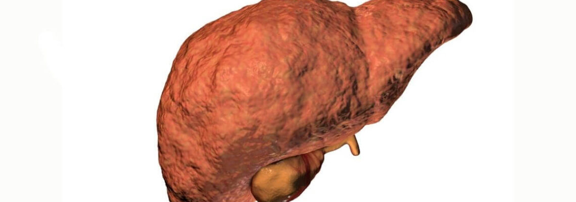 21-Day Liver Fibrosis Recovery Program